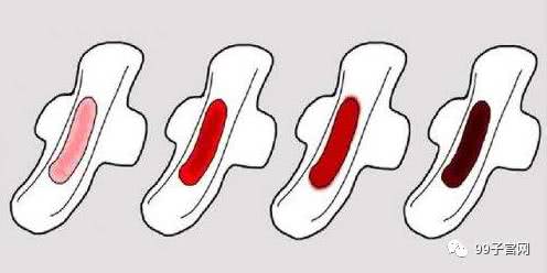 月经颜色暗，还有黑色血块，是因为“宫寒”吗？