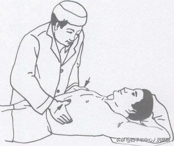 肋骨骨折恢复期一般多久,13根肋骨骨折