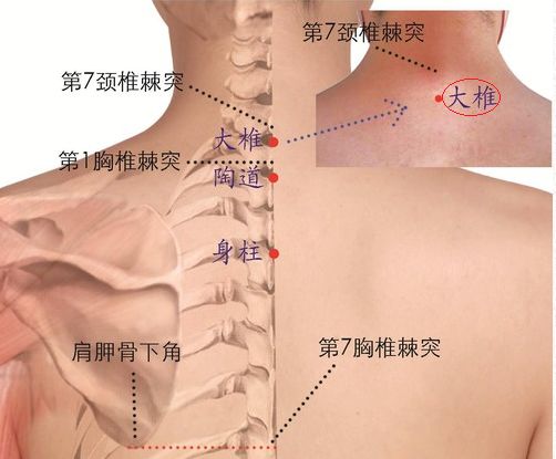 中医解决口腔溃疡的方法,中医治疗口腔溃疡的方剂