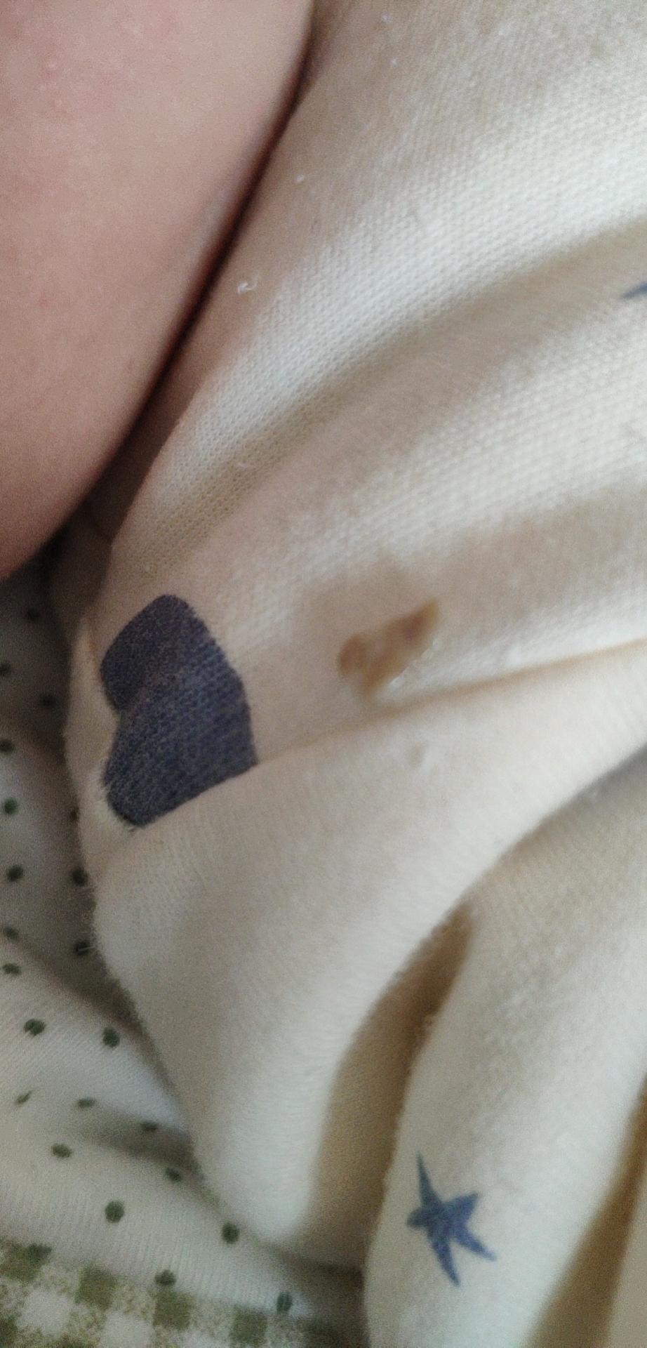 宝宝鼻腔有鼻屎,宝宝鼻腔有鼻屎怎么解决