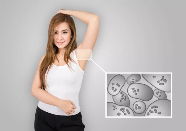 得了狐臭的原因是什么,造成狐臭的原因是什么