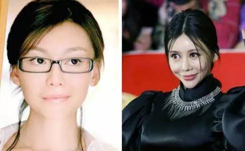 整容自毁前程的女明星,整容失去灵魂的女明星