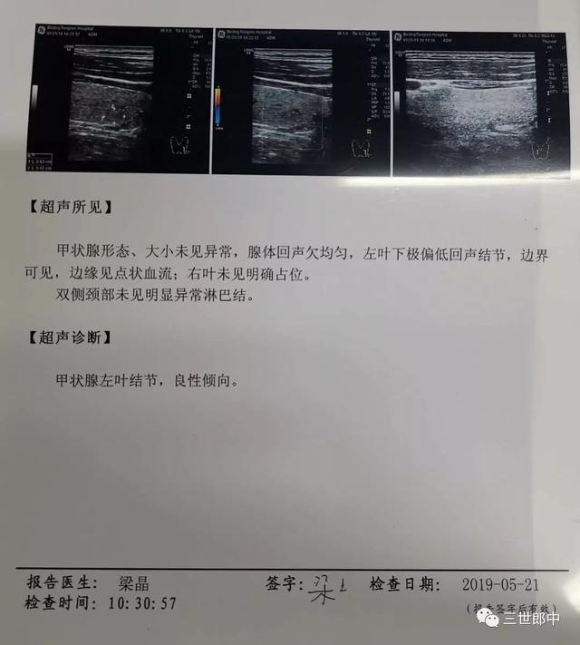 软坚散结专治癌症结节,病理检查发现结节是癌症吗