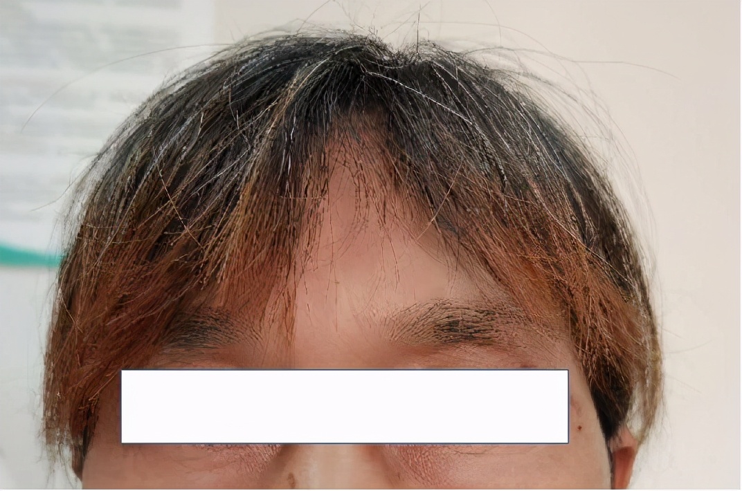 阿胶补气补血配方,阿胶固元膏补血吗