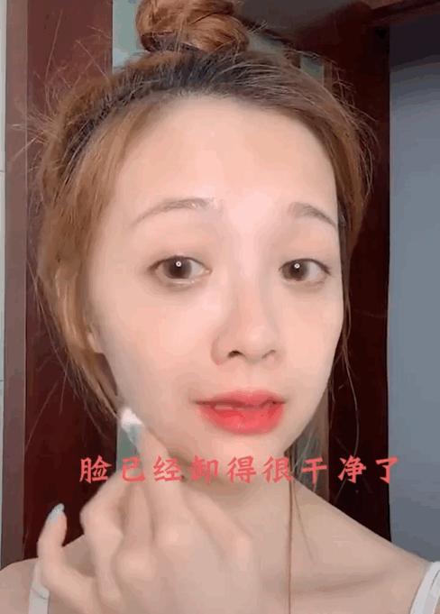 打玻尿酸和瘦脸针有什么后遗症,瘦脸针玻尿酸危害