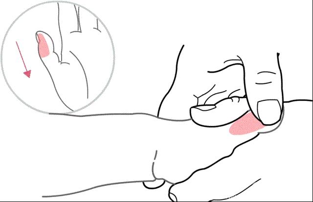 小儿总是夜间咳嗽,小儿夜间频繁咳嗽