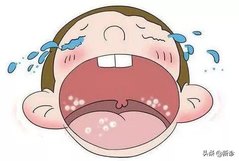 鹅口疮和白口疮有差别吗,如何避免鹅口疮