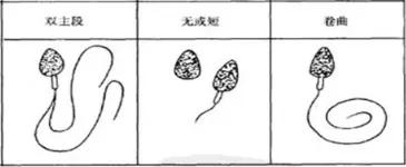 怀孕这件大事,怀孕这个事容易么