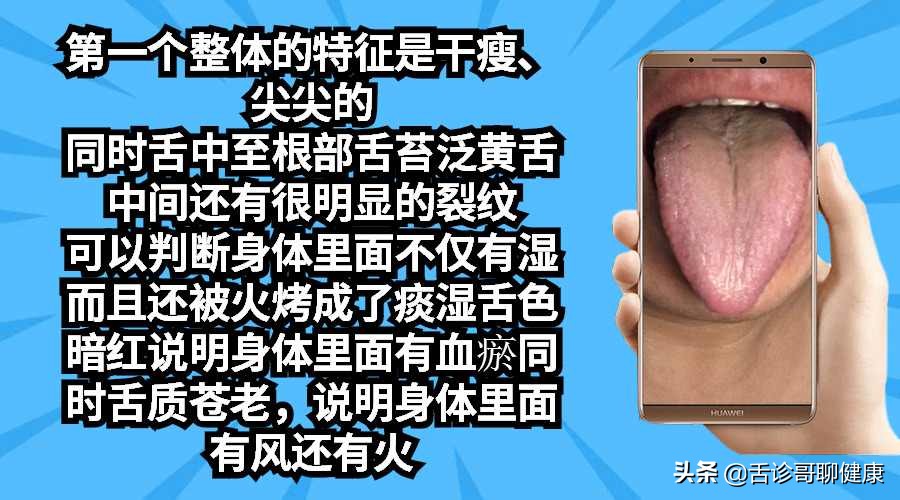 舌诊哥说亚健康,抖音舌诊哥舌象分析与感悟