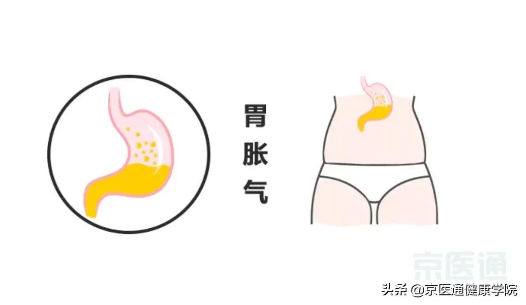 一分钟解决胃肠胀气的方法,胃肠道胀气做什么动作来缓解