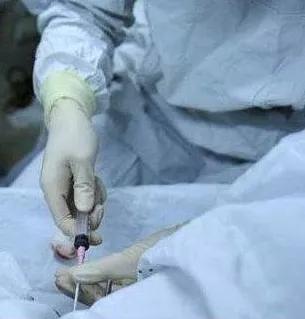 享生课堂：“冻卵”案背后的单身女性引出的生育权