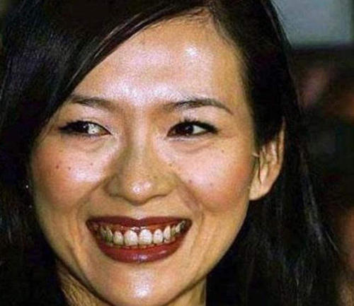 皮秒激光就是镭射净肤吗,皮秒激光是怎么样的