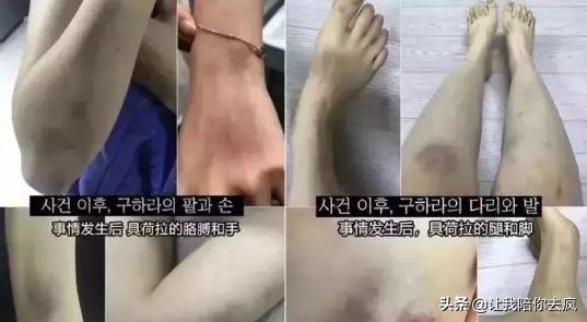 荷拉用生命告诉我们远离渣男，珍惜生命，是女孩们需要补的课