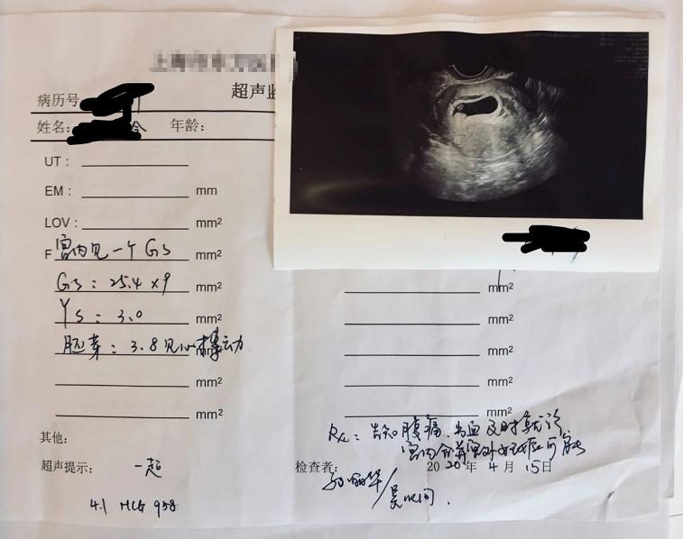 反复移植未着床，改变策略轻松怀孕