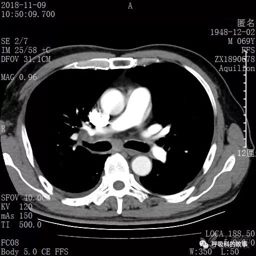 怎么应用统计学做调查,统计学方法可以解决的主要问题