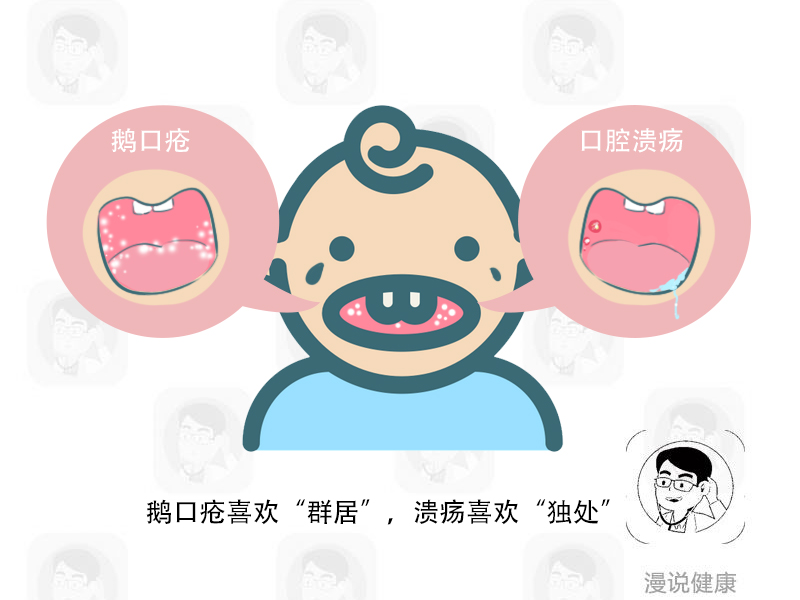 婴儿口腔溃疡和鹅口疮的区别,鹅口疮是皮肤还是口腔病