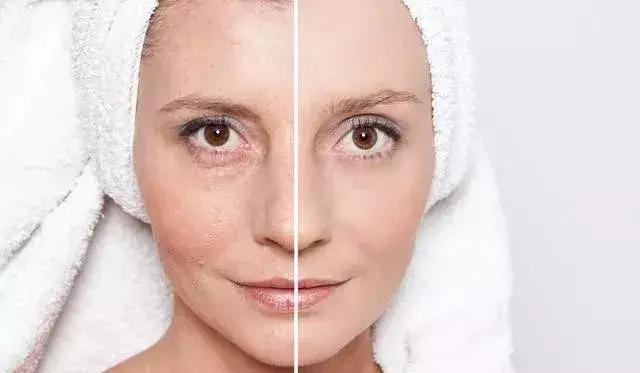 毛孔粗大如何改善最有效,怎么改善毛孔粗大生活小妙招