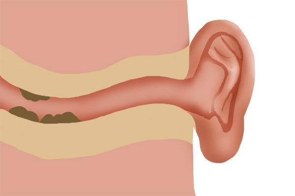 为什么耳朵有耳油流出,为什么有人耳朵里流油