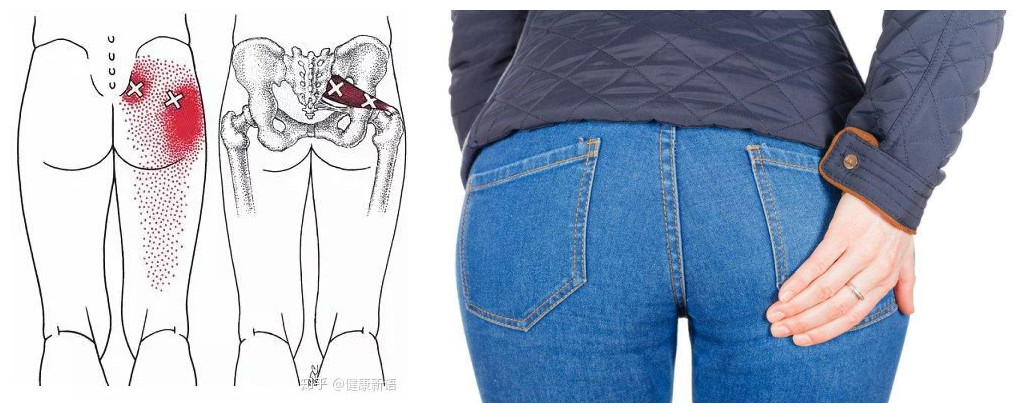 梨状肌和腰椎疼的区别,梨状肌和腰椎间盘有什么区别
