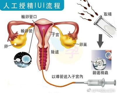 犬人工授精教程,人工授精怎么做