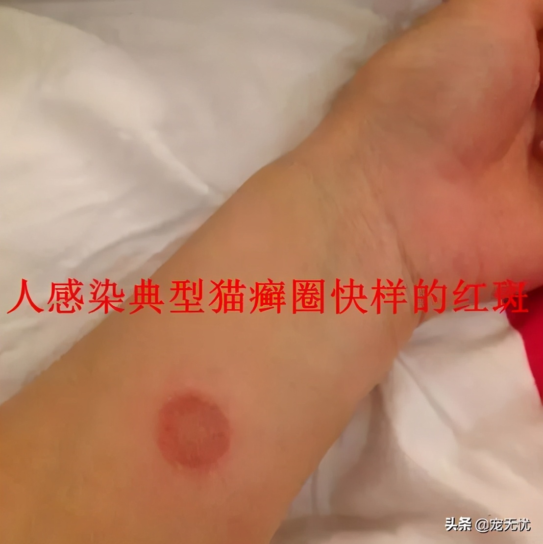 猫咪感染癣,猫咪感染猫癣怎么办