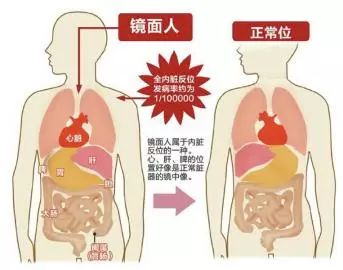 看到家里的这样东西，下身浮肿自然消