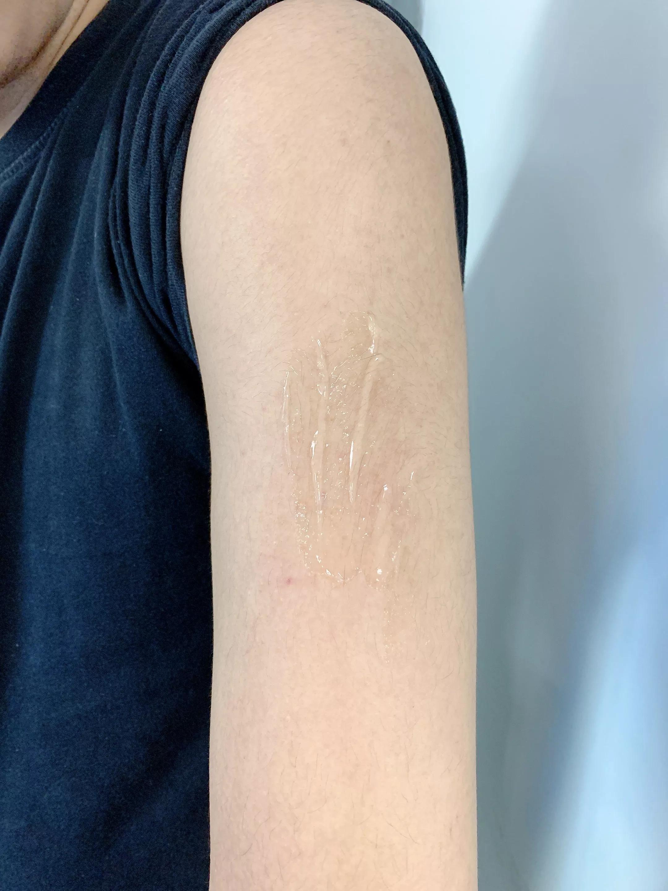 男朋友手臂长小疙瘩是什么原因,男朋友手臂上很多小痘痘是什么