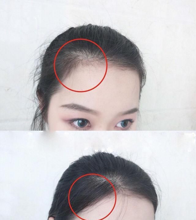 发际线高怎么用刘海遮,怎么剪刘海才能遮住发际线高