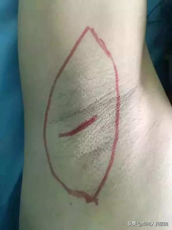 对味道敏感的人怎么办,对味道特别敏感的人真的很崩溃