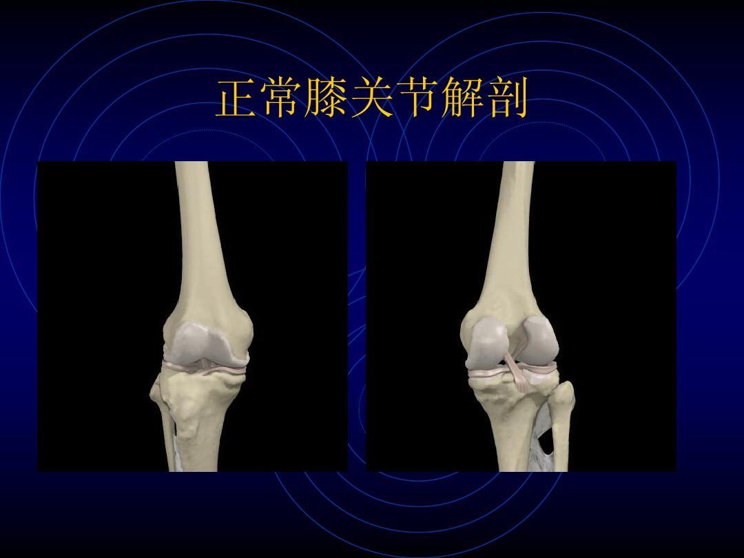膝关节脱位，可以采取闭合复位，一般需要对关节内的血肿进行清除