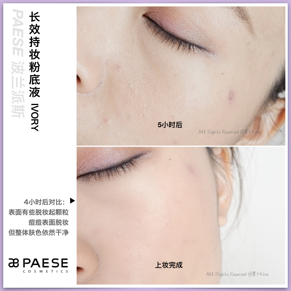遮瑕力强的粉底液瑕疵皮,百元爆款粉底液