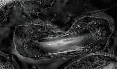 死于癌症后细胞永生,死于癌症