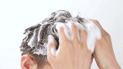 头上又油又有头皮屑又痒怎么办,头上又痒又油有头屑