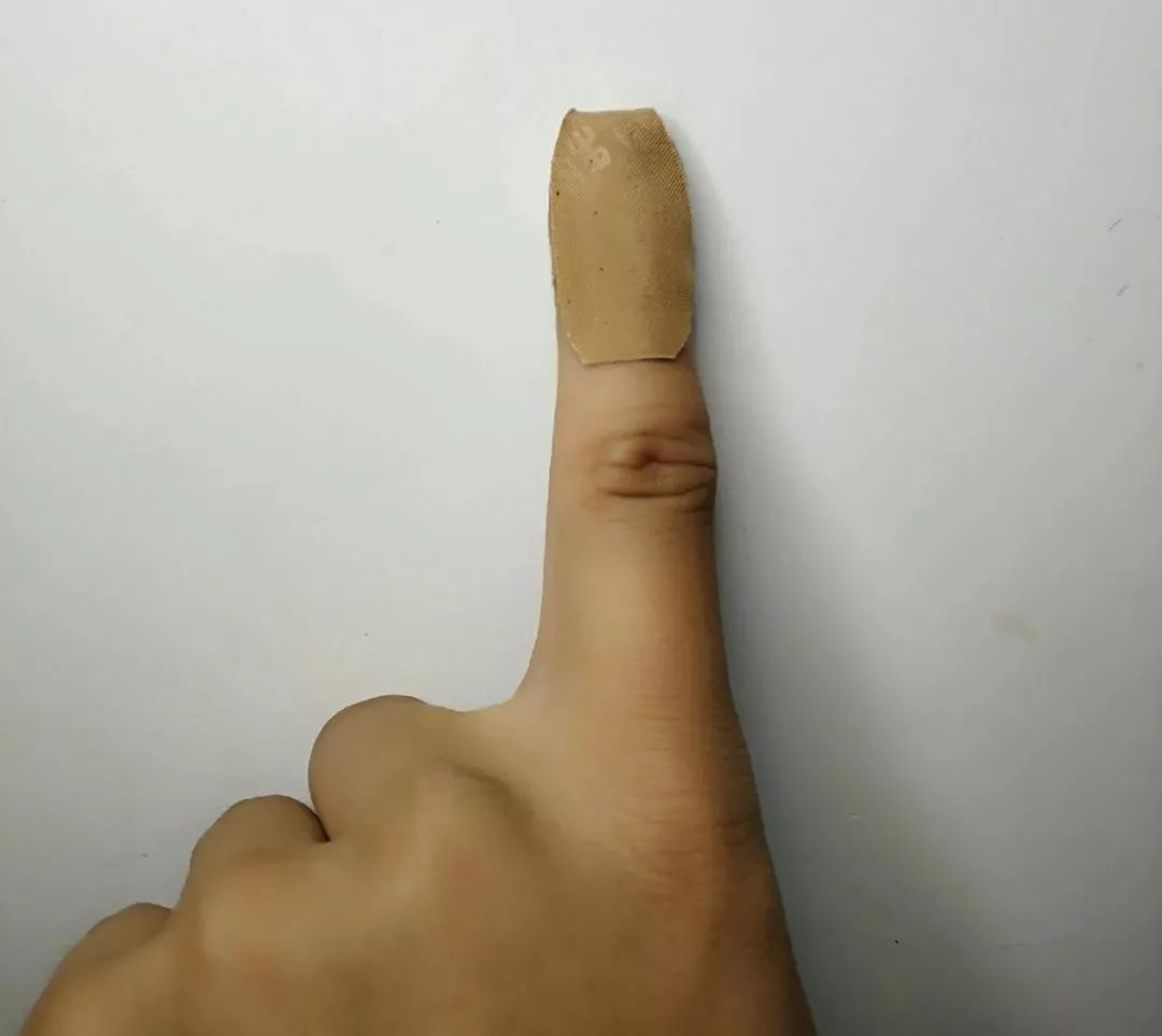 特殊敷料敷贴,手术缝合口粘贴敷料使用方法