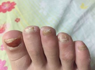 鍚嶅尰涓撴爮绉嬪鍏荤敓,鍚嶅尰涓撴爮杩滅鐥涢