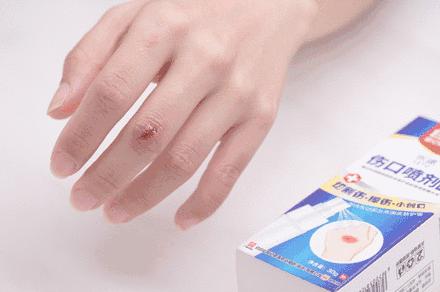 比创可贴好用,最好用的液体创可贴