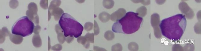 看懂血常规报告单只需明白这四项,宝宝做血常规要注意什么