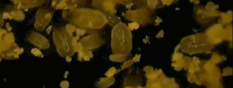 头上又油又有头皮屑又痒怎么办,头上又痒又油有头屑