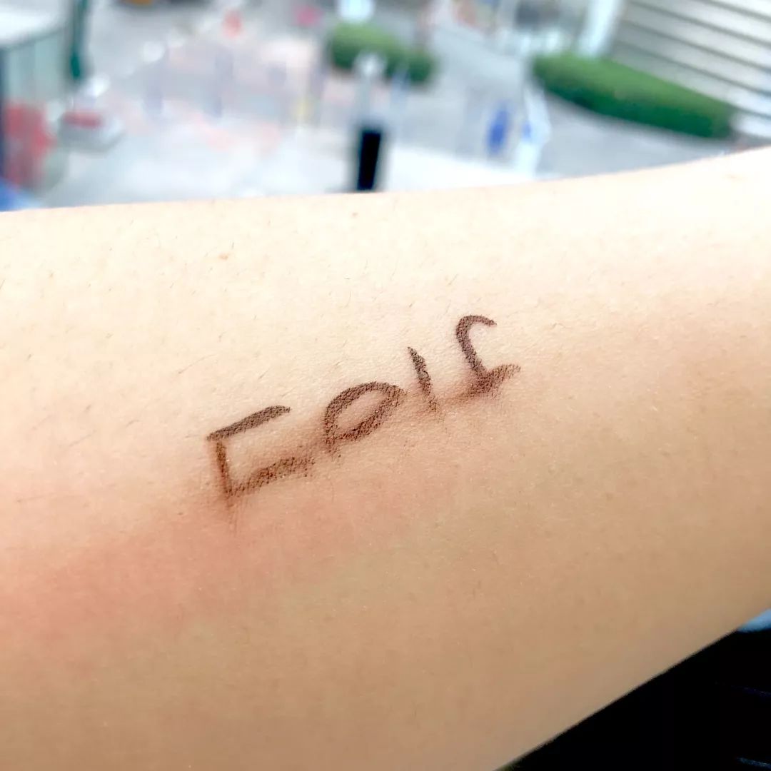 108块就能治好脸，感觉之前的钱都白花了