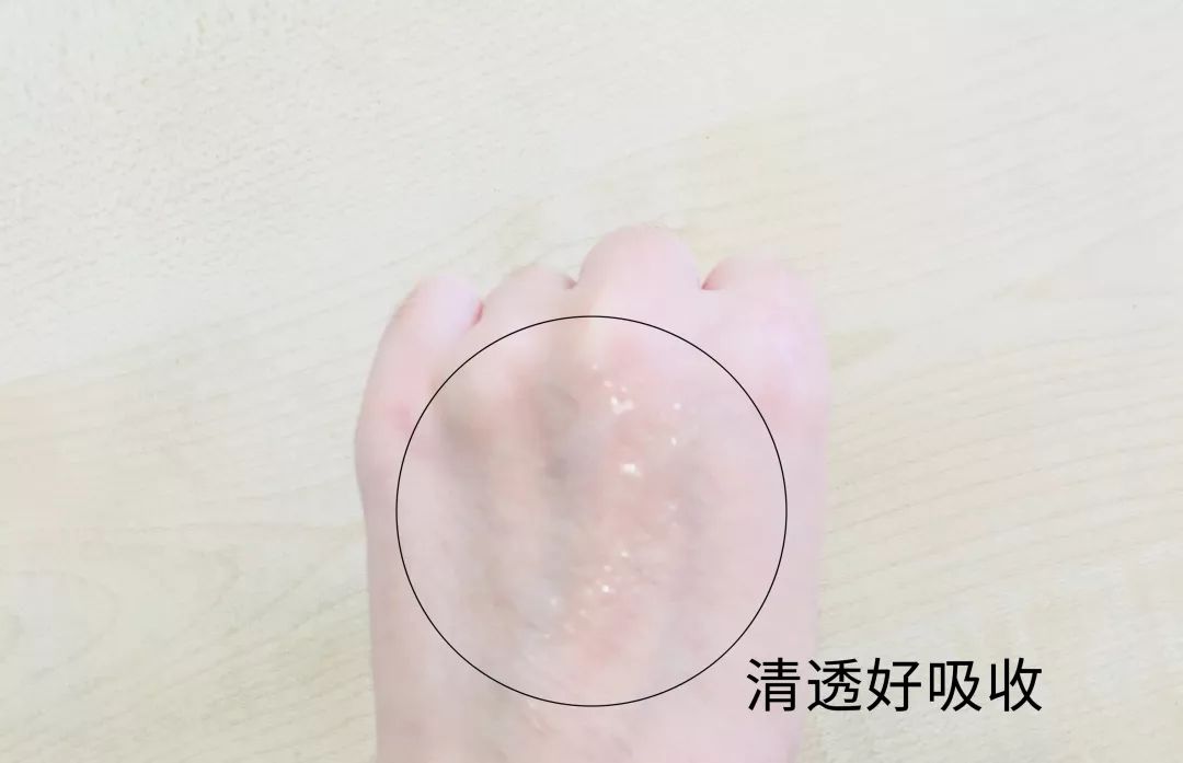 如何拯救长痘的脸,长痘肌肤日常如何护理