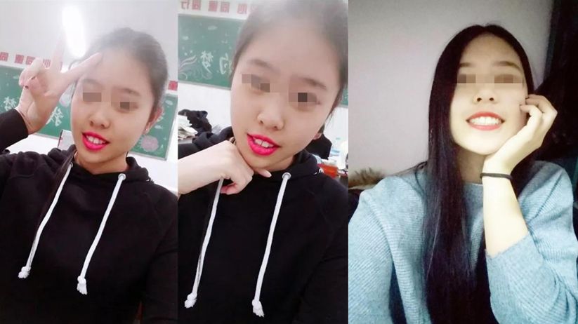 今年种植牙齿进医保了吗,矫正牙齿不给报销吗