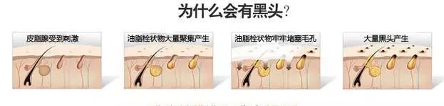 喷一喷,黑头油脂自动溶解!日本爆款清洁喷雾还你一个嫩*b嫩**aby肌!