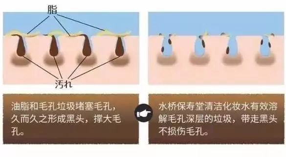 喷一喷,黑头油脂自动溶解!日本爆款清洁喷雾还你一个嫩*b嫩**aby肌!