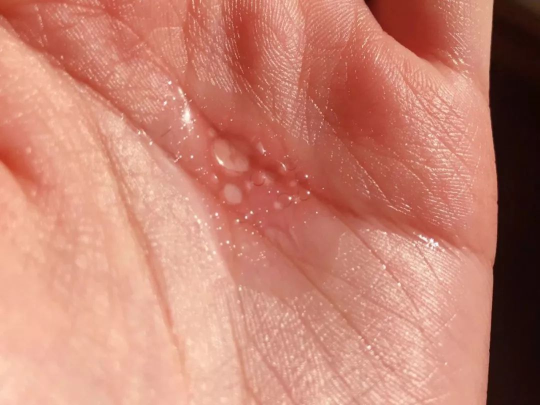 小白鼠敏感,小白鼠身上痒怎么办