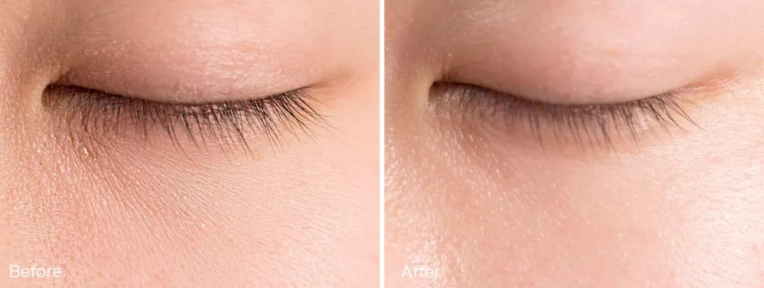 去细纹不长脂肪粒平价眼霜推荐,眼霜平价推荐去细纹30岁以上