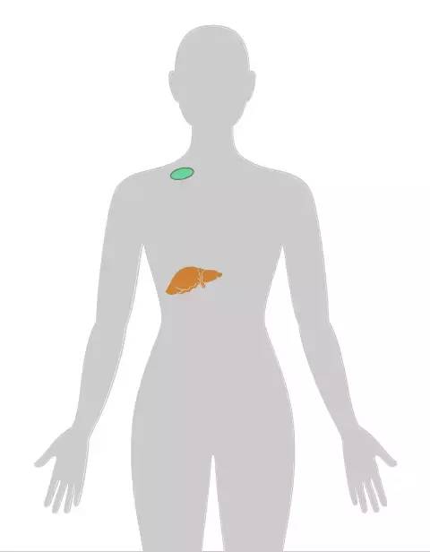 20个癌症的真实案例,13种癌症最新研究报告