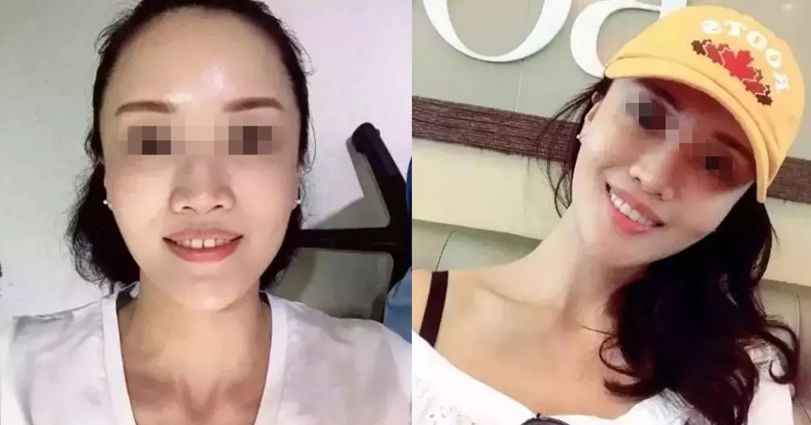 国家牙齿矫正种牙新政策,能全口种植牙齿一般需要多少钱