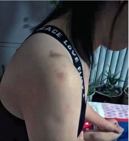 女孩被人掌掴事件,女孩遭掌掴事件