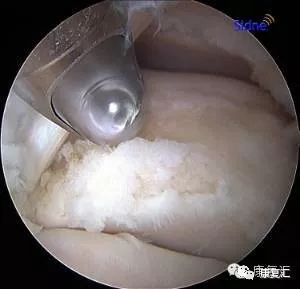 脚踝扭伤很痛怎么医,脚踝内侧筋痛扭伤详细康复训练