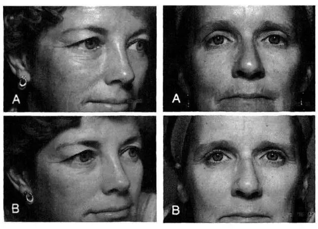 药妆和普通护肤品有什么区别,药妆和医用护肤品的区别